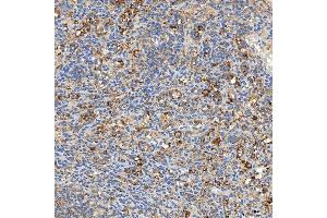 IHC analysis of SNPH using anti-SNPH antibody (ABIN7601724). (Syntaphilin 抗体  (AA 43-482))