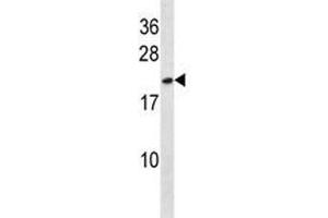 HMGB3 antibody western blot analysis in NCI-H292 lysate. (HMGB3 抗体  (AA 50-79))