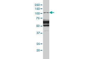 RASA1 monoclonal antibody (M01), clone 2C12 Western Blot analysis of RASA1 expression in IMR-32 . (RASA1 抗体  (AA 948-1047))
