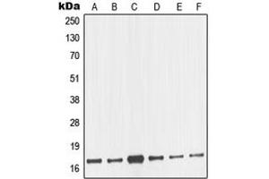 Western blot analysis of nm23-H2 expression in MCF7 (A), HeLa (B), A431 (C), Jurkat (D), K562 (E), BJAB (F) whole cell lysates. (NME2 抗体  (Center))