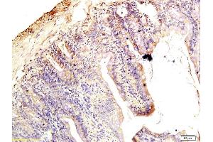 Formalin-fixed and paraffin embedded rat intestine tissue labeled with Anti-Claudin 1 Polyclonal Antibody, Unconjugated (ABIN686407) followed by conjugation to the secondary antibody and DAB staining (Claudin 1 抗体  (AA 121-211))