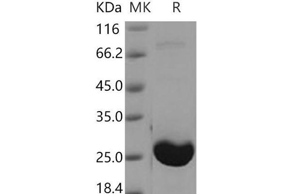 Adenylate Kinase 1 Protein (AK1) (His tag)