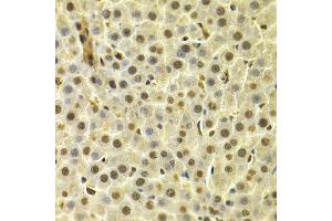 Immunohistochemistry of paraffin-embedded rat liver using DTNBP1 antibody at dilution of 1:100 (x400 lens). (DTNBP1 抗体)