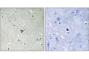 Immunohistochemistry analysis of paraffin-embedded human brain tissue, using Bax (Ab-184) Antibody. (BAX 抗体  (AA 143-192))