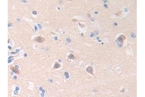 Detection of HLTF in Human Brain Tissue using Polyclonal Antibody to Helicase Like Transcription Factor (HLTF) (HLTF 抗体  (AA 837-996))
