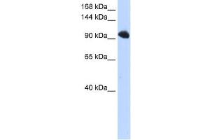 SFRS8 antibody used at 1 ug/ml to detect target protein. (SFRS8 抗体)