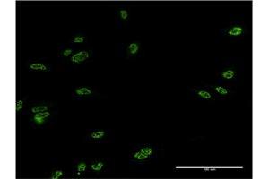 Immunofluorescence (IF) image for anti-LIM Homeobox 4 (LHX4) (AA 291-390) antibody (ABIN529957)