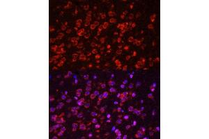 Immunofluorescence analysis of mouse brain using STAT3 antibody.