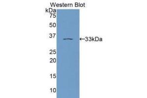 Western Blotting (WB) image for anti-Protein Kinase C, epsilon (PRKCE) (AA 403-672) antibody (ABIN1172891) (PKC epsilon 抗体  (AA 403-672))