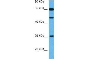 Host:  Rabbit  Target Name:  TP73  Sample Tissue:  Mouse Kidney  Antibody Dilution:  1ug/ml (Tumor Protein p73 抗体  (Middle Region))
