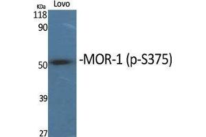 Western Blot (WB) analysis of specific cells using Phospho-MOR-1 (S375) Polyclonal Antibody. (Mu Opioid Receptor 1 抗体  (pSer375))