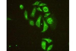 Detection of MAP4 in Hela cells using Polyclonal Antibody to Microtubule Associated Protein 4 (MAP4) (MAP4 抗体  (AA 2-250))