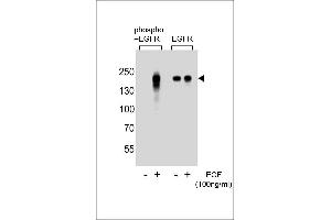 Western blot analysis of extracts from A431 cells, untreated or treated with EGF, using phospho EGFR- (left) or ErBB2 antibody (right) (EGFR 抗体  (pTyr1172))