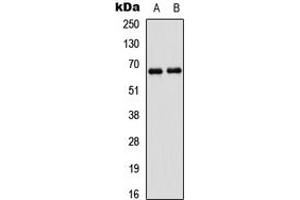 Western blot analysis of PAK1 expression in A431 (A), HEK293T (B) whole cell lysates. (PAK1 抗体  (Center))