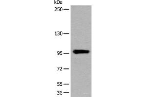 Western blot analysis of Human heart tissue lysate using UNC45B Polyclonal Antibody at dilution of 1:600 (UNC45B 抗体)