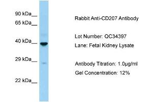 Host: Rabbit Target Name: CD207 Sample Type: Fetal Kidney Antibody Dilution: 1. (CD207 抗体  (C-Term))