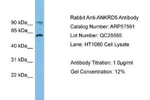 WB Suggested Anti-ANKRD5  Antibody Titration: 0. (ANKRD5 抗体  (N-Term))