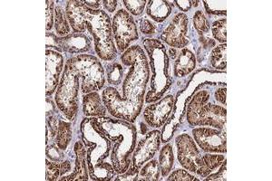Immunohistochemical staining of human kidney with OR8S1 polyclonal antibody  shows strong cytoplasmic positivity in cells in tubules at 1:50-1:200 dilution. (OR8S1 抗体)