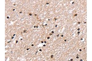 The image on the left is immunohistochemistry of paraffin-embedded Human brain tissue using ABIN7130904(RNF40 Antibody) at dilution 1/25, on the right is treated with fusion protein. (RNF4 抗体)