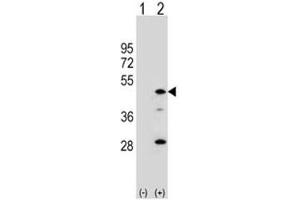 Western blot analysis of AADAC antibody and 293 cell lysate either nontransfected (Lane 1) or transiently transfected (2) with the AADAC gene. (AADAC 抗体  (AA 273-300))