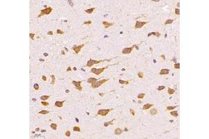 Immunohistochemistry of paraffin embedded rat brain using UQCC (ABIN7076094) at dilution of 1: 1000 (400x lens)