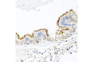 Immunohistochemistry of paraffin-embedded human trachea using CD44 antibody at dilution of 1:100 (x40 lens). (CD44 抗体)