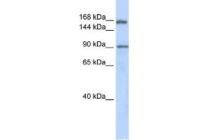 WB Suggested Anti-AFF2 Antibody Titration:  0. (AFF2 抗体  (Middle Region))