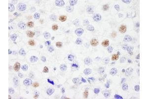 Immunohistochemistry (IHC) image for anti-Interferon Regulatory Factor 3 (IRF3) (AA 100-150) antibody (ABIN7449377)