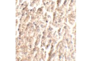 Immunohistochemical analysis of ANGPT2 in mouse liver tissue with ANGPT2 polyclonal antibody  at 2. (Angiopoietin 2 抗体  (C-Term))