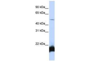 Image no. 1 for anti-One Cut Homeobox 1 (ONECUT1) (N-Term) antibody (ABIN6740547) (ONECUT1 抗体  (N-Term))