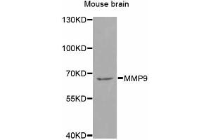 Western blot analysis of extracts of mouse brain, using MMP9 antibody (ABIN4904400) at 1:1000 dilution. (MMP 9 抗体)