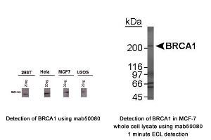 Image no. 1 for anti-Breast Cancer 1 (BRCA1) (AA 1314-1600), (AA 1314-1864) antibody (ABIN363234) (BRCA1 抗体  (AA 1314-1600, AA 1314-1864))