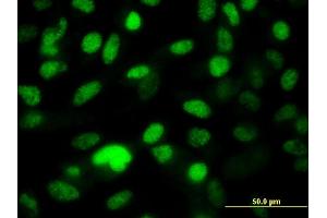 Immunofluorescence of monoclonal antibody to PPP1R8 on HeLa cell. (PPP1R8 抗体  (AA 1-209))
