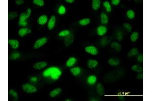 Immunofluorescence of monoclonal antibody to PPP1R8 on HeLa cell. (PPP1R8 抗体  (AA 1-209))