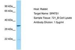 Image no. 1 for anti-Spermatogenesis Associated, Serine-Rich 1 (SPATS1) (AA 21-70) antibody (ABIN6750229) (SPATS1 抗体  (AA 21-70))