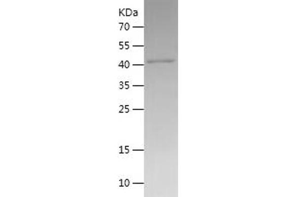 IDO1 Protein (AA 1-403) (His tag)