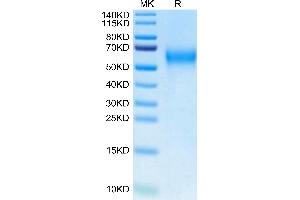 Biotinylated Cynomolgus IL-2 R gamma on Tris-Bis PAGE under reduced condition. (IL2RG Protein (AA 23-254) (His tag,Biotin))