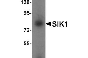 Western blot analysis of SIK1 in human small intestine tissue lysate with SIK1 antibody at 1 µg/mL. (SIK1 抗体  (Middle Region))