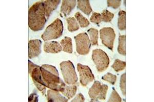 Formalin-fixed and paraffin-embedded human skeletal muscle reacted with Denatured ATG1 Antibody , which was peroxidase-conjugated to the secondary antibody, followed by DAB staining. (ULK1 抗体)