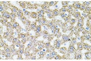 Immunohistochemistry of paraffin-embedded Rat liver using ALDH1A1 Polyclonal Antibody at dilution of 1:100 (40x lens). (ALDH1A1 抗体)