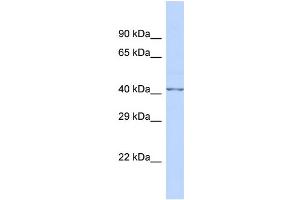 Host:  Rabbit  Target Name:  FKTN  Sample Type:  Fetal Brain lysates  Antibody Dilution:  1. (Fukutin 抗体  (N-Term))
