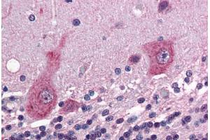 Human Brain, Cerebellum (formalin-fixed, paraffin-embedded) stained with GRIK5 antibody ABIN343908 at 5 ug/ml followed by biotinylated goat anti-rabbit IgG secondary antibody ABIN481713, alkaline phosphatase-streptavidin and chromogen. (GRIK5 抗体  (C-Term))