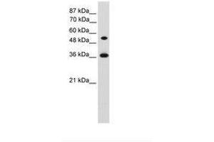 Image no. 1 for anti-Homeobox C11 (HOXC11) (AA 152-201) antibody (ABIN203334) (HOXC11 抗体  (AA 152-201))