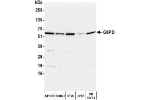 Western Blotting (WB) image for anti-Glucose-6-Phosphate Dehydrogenase (G6PD) (AA 50-100) antibody (ABIN7449226)