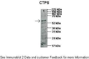 Western Blotting (WB) image for anti-CTP Synthase (CTPS) (N-Term) antibody (ABIN2782465)