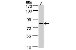 WB Image Sample (30 ug of whole cell lysate) A:H1299 7. (F13A1 抗体  (N-Term))