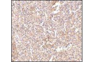 Immunohistochemistry of STEAP1 in human spleen tissue with this product at 2. (STEAP1 抗体  (Center))