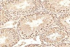 Immunohistochemistry analysis of paraffin-embedded rat testis using,MCM4 (ABIN7074631) at dilution of 1: 2400 (MCM4 抗体)