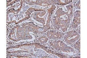 IHC analysis of DDR1 using anti-DDR1 antibody (ABIN7601407). (DDR1 抗体  (AA 341-909))