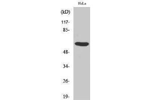 Western Blotting (WB) image for anti-PHD Finger Protein 1 (PHF1) (Internal Region) antibody (ABIN3176864) (PHF1 抗体  (Internal Region))